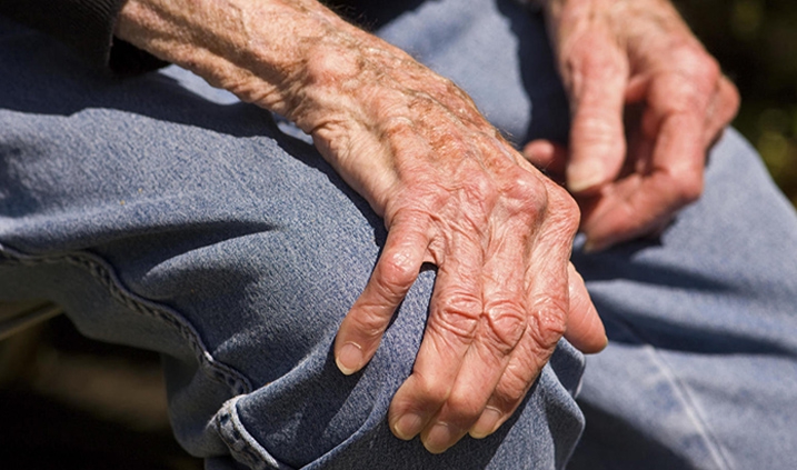 la artritis en personas mayores
