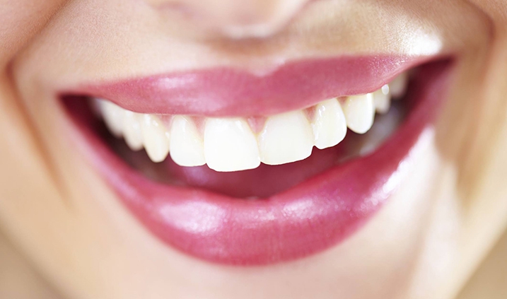 evitar la caries dental