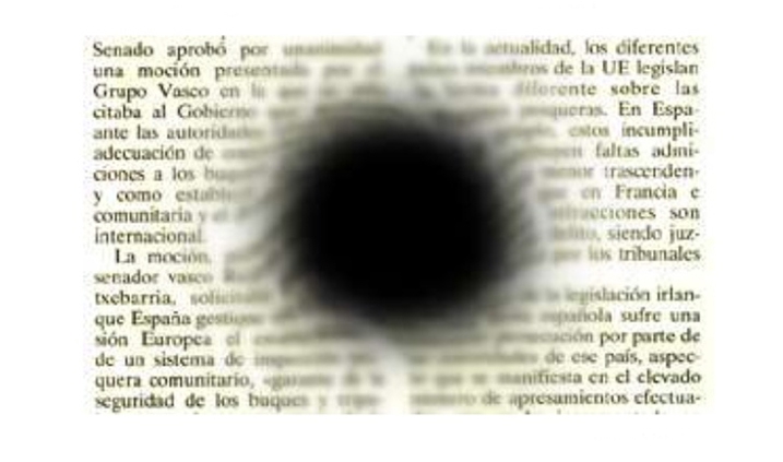 ejemplo de degeneración macular