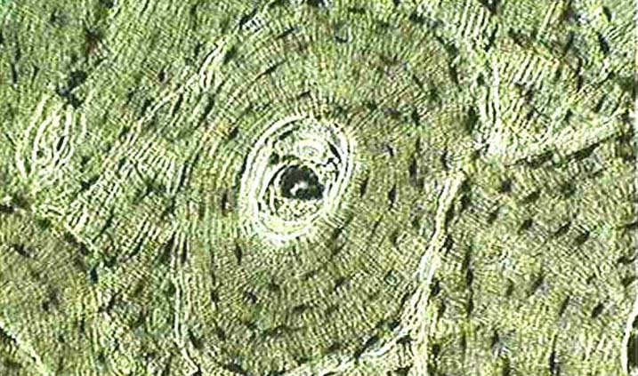 osteoporosis under the microscope